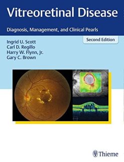 Vitreoretinal Disease: Diagnosis, Management, and Clinical Pearls, 2nd Edition (EPUB)