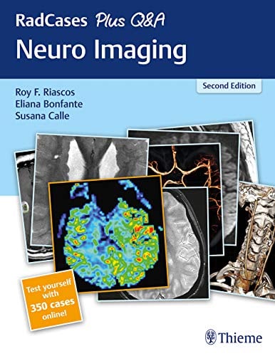 RadCases Plus Q&A Neuro Imaging, 2nd Edition (Original PDF from Publisher)