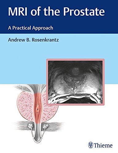 MRI of the Prostate: A Practical Approach (EPUB)