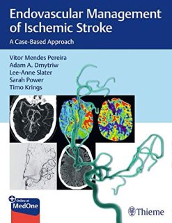 Endovascular Management of Ischemic Stroke: A Case-Based Approach (Original PDF from Publisher)