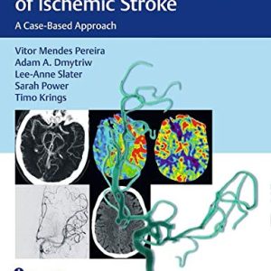 Endovascular Management of Ischemic Stroke: A Case-Based Approach (Original PDF from Publisher)