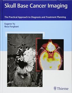 Skull Base Cancer Imaging: The Practical Approach to Diagnosis and Treatment Planning (Original PDF from Publisher)