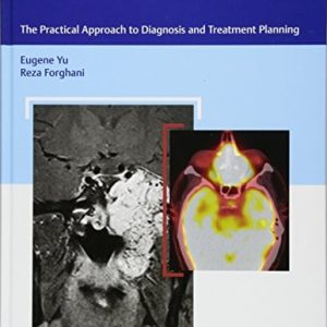Skull Base Cancer Imaging: The Practical Approach to Diagnosis and Treatment Planning (Original PDF from Publisher)