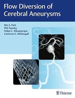 Brain Arteriovenous Malformations and Arteriovenous Fistulas (EPUB)