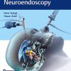 Controversies in Neuroendoscopy (Original PDF from Publisher)
