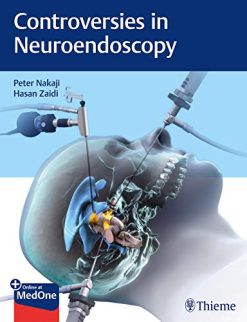 Controversies in Neuroendoscopy (Original PDF from Publisher)