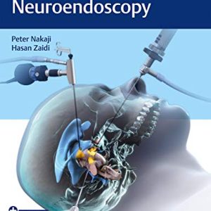Controversies in Neuroendoscopy (Original PDF from Publisher)