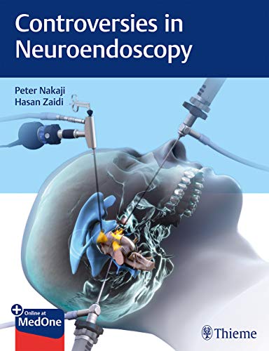 Controversies in Neuroendoscopy (Original PDF from Publisher)