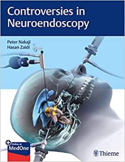 Controversies in Neuroendoscopy (EPUB)