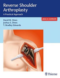 Reverse Shoulder Arthroplasty: A Practical Approach (PDF)