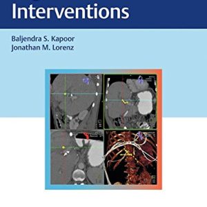 Digestive Disease Interventions (Original PDF from Publisher)