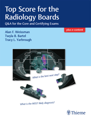 Top Score for the Radiology Boards (EPUB)