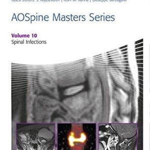 AOSpine Masters Series, Volume 10: Spinal Infections (PDF)