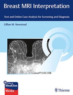 Breast MRI Interpretation: Screening and Diagnosis (Original PDF from Publisher)