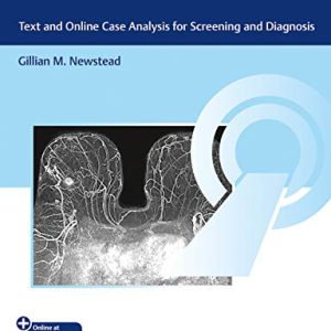 Breast MRI Interpretation: Screening and Diagnosis (Original PDF from Publisher)