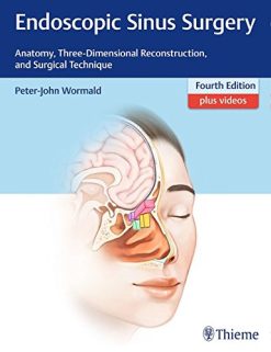 Endoscopic Sinus Surgery: Anatomy, Three-Dimensional Reconstruction, and Surgical Technique, 4th Edition (Original PDF from Publisher)