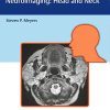 Differential Diagnosis in Neuroimaging: Head and Neck (PDF)