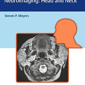 Differential Diagnosis in Neuroimaging: Head and Neck (PDF)