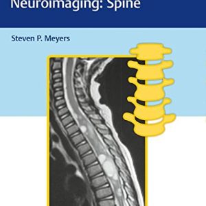 Differential Diagnosis in Neuroimaging: Spine (PDF)