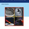 Ultrasound Q&A Review for the Boards (Original PDF from Publisher)