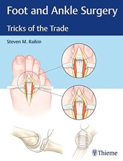 Foot and Ankle Surgery: Tricks of the Trade (EPUB)