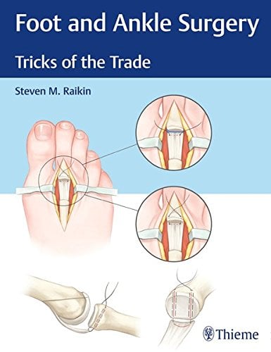 Foot and Ankle Surgery: Tricks of the Trade (EPUB)