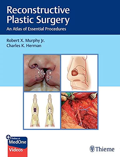 Reconstructive Plastic Surgery: An Atlas of Essential Procedures (Original PDF from Publisher+Videos)