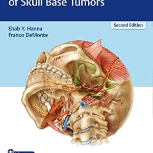 Comprehensive Management of Skull Base Tumors, 2nd Edition (Original PDF from Publisher + Videos)