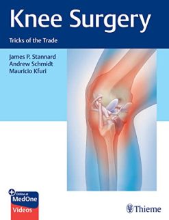 Knee Surgery: Tricks of the Trade (Original PDF from Publisher+Videos)