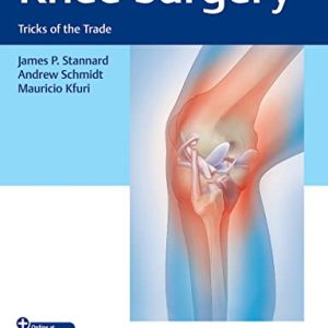 Knee Surgery: Tricks of the Trade (Original PDF from Publisher+Videos)