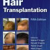 Hair Transplantation, 5ed (Original PDF from Publisher + Videos)