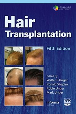 Hair Transplantation, 5ed (Original PDF from Publisher + Videos)