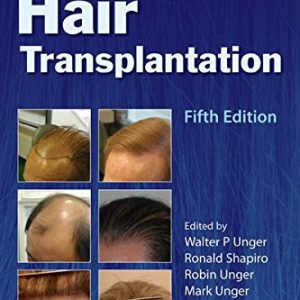 Hair Transplantation, 5ed (Original PDF from Publisher + Videos)