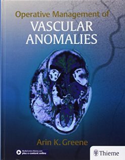 Operative Management of Vascular Anomalies (EPUB)