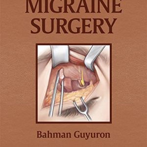 Migraine Surgery (Retail PDF + Videos)