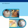 Video Atlas of Arthroscopic Rotator Cuff Repair (Original PDF from Publisher + Videos)