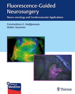 Fluorescence-Guided Neurosurgery: Neuro-oncology and Cerebrovascular Applications (PDF+Videos)