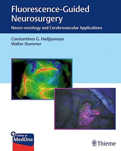 Fluorescence-Guided Neurosurgery: Neuro-oncology and Cerebrovascular Applications (PDF+Videos)