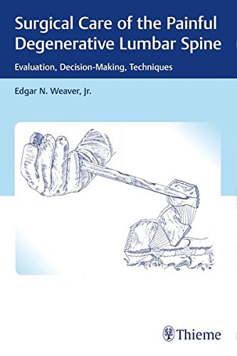 Surgical Care of the Painful Degenerative Lumbar Spine: Evaluation, Decision-Making, Techniques (ePUB)