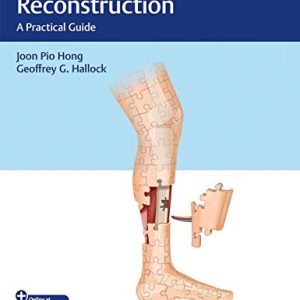 Lower Extremity Reconstruction: A Practical Guide (Original PDF from Publisher+Videos)