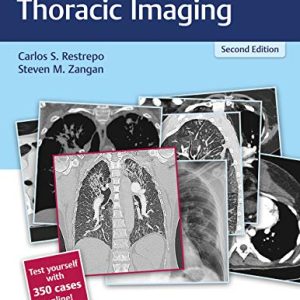 RadCases Plus Q&A Thoracic Imaging, 2nd Edition (Original PDF from Publisher)