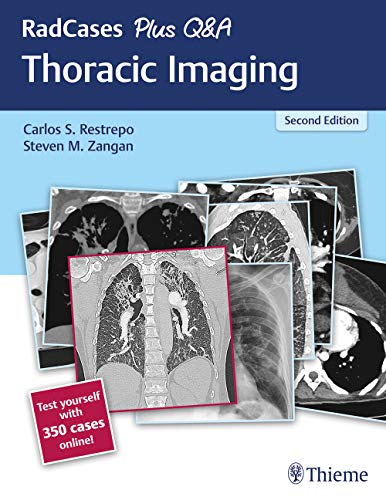 RadCases Plus Q&A Thoracic Imaging, 2nd Edition (Original PDF from Publisher)