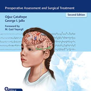 Pediatric Epilepsy Surgery: Preoperative Assessment and Surgical Treatment, 2nd Edition (Original PDF from Publisher)
