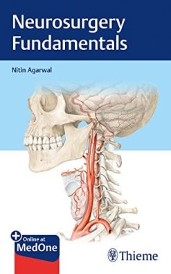 Neurosurgery Fundamentals (PDF)