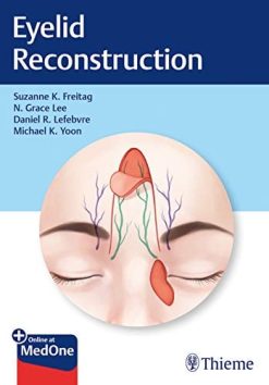 Eyelid Reconstruction (Original PDF from Publisher)