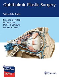 Ophthalmic Plastic Surgery: Tricks of the Trade (Original PDF from Publisher)