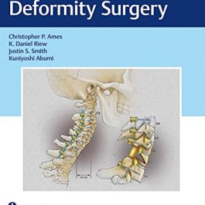Cervical Spine Deformity Surgery (Original PDF from Publisher)
