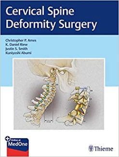 Cervical Spine Deformity Surgery (EPUB)