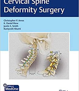 Cervical Spine Deformity Surgery (EPUB)