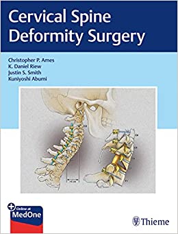 Cervical Spine Deformity Surgery (EPUB)